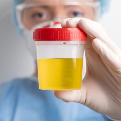 lab-doctor-performing-medical-exam-urine (1)